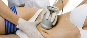 liposucción tarragona liposucción tarragona